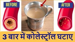 केवल 3 बार में कोलेस्ट्रॉल को जड़ से ख़तम करे  Cholesterol Treatment at Home  Artery Cleanser Remedy [upl. by Robyn]