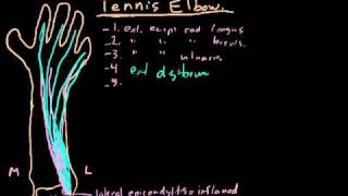 Tennis Elbow Treatment Prevention amp Rehabilitation Exercises Explained [upl. by Claybourne]