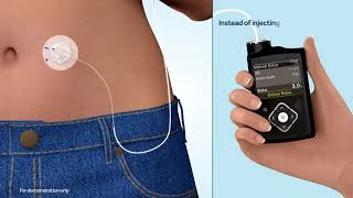 What is an insulin pump [upl. by Notnerb]