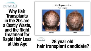 Why Hair Transplants Dont Work in the 20s and Treatment to Manage Hair Loss at This Age [upl. by Jamal]