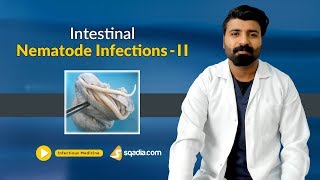 Intestinal Nematode Infections II  Medicine Lectures  Medical Education  VLearning [upl. by Zinn]