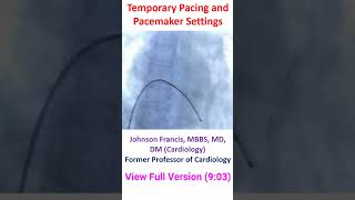 Temporary Pacing and Pacemaker Settings [upl. by Tadich410]