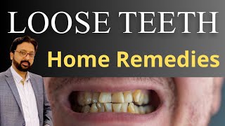 How do Dentist FIX Loose Teeth  Loose Tooth Treatment Home Remedies  Tooth Mobility [upl. by Carolynn73]