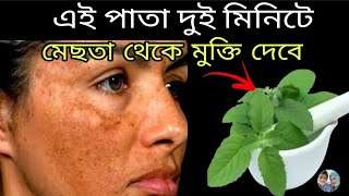 এই পাতা একবার লাগান চোখের পলকে মেছতা দূর হবে২ মিনিটে মেছতা দূর করার উপায়mesta dur korar upay [upl. by Ecirtael]