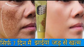 My Fair Cream Complete Review हिन्दी मैं My Fair Cream Remove PigmentationMelasma And Scars [upl. by Chor]