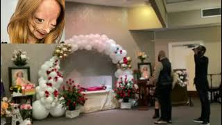 Adalia Rose last journey video Adalia Rose has passed away [upl. by Darrey]