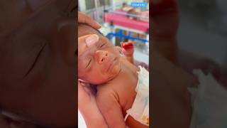 Newborn baby care video medical viralvideo [upl. by Catharina]