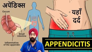 Appendicitis  अपेंडिक्स  Right Lower abdominal Pain  DrEducation [upl. by Gervais]