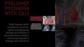 Ultrasound kidneyhealth medicalimaging youtubeshorts video urology doctor sonography usg [upl. by Arytahs723]