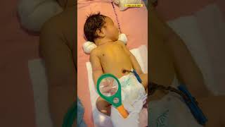 Umbilical infection 4days baby🥺🥺newbornbabybabynewbornnewborncare [upl. by Acenom]