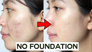 How to Cover Acne amp Blemishes WITHOUT Foundation • easy amp non cakey [upl. by Ailemrac]