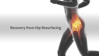 Recovery from Hip Resurfacing [upl. by Tomlin]