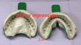 mixing of alginate primary impression [upl. by Bowles]