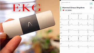 EKG at Home  KardiaMobile 6Lead Personal EKG Monitor [upl. by Meras]