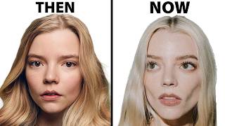 Anya TaylorJoys NEW FACE  Plastic Surgery Analysis [upl. by Sanburn]