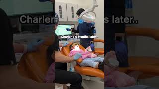 Highly observant child remembers instructions TOO well 😂 Pediatric Dentist [upl. by Rein647]