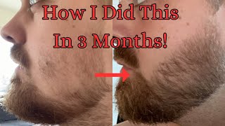 This Is Exactly What I Did To Increase My Beard Growth In 3 Months [upl. by Haididej]