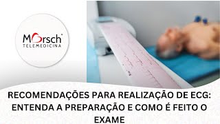 RECOMENDAÇÕES PARA REALIZAÇÃO DE ECG ENTENDA A PREPARAÇÃO E COMO É FEITO O EXAME [upl. by Okimik860]