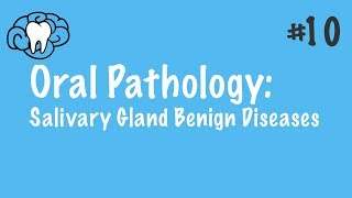 Oral Pathology  Salivary Gland Benign Diseases  INBDE ADAT [upl. by Ecirual49]