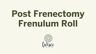 Post Frenectomy Frenulum Roll [upl. by Longan]