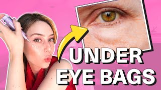 How To Get Rid Of Under Eye Bags amp Puffy Eyes  Dr Shereene Idriss [upl. by Attevroc]