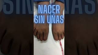 ¿Dónde están las uñas 😮 podologia podiatry medicina [upl. by Vasos767]