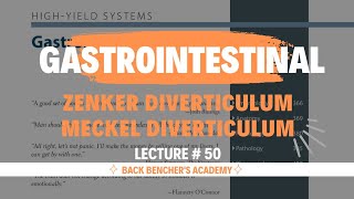 Zenker Diverticulum Meckel Diverticulum  Gastrointestinal  50  First Aid USMLE Step 1 2023 [upl. by Ola]