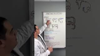 Ischemic Stroke  Middle Cerebral Artery Stroke MCA shorts [upl. by Benny]