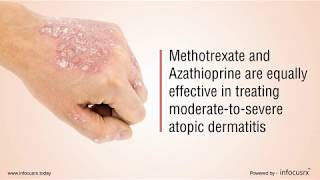 Methotrexate and Azathioprine are equally effective in moderatetosevere Atopic Dermatitis [upl. by Groveman454]