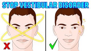 The 4 minute natural method for vestibular disorder  migraines amp imbalance [upl. by Okoy]