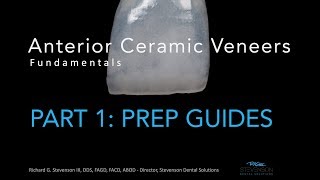 Anterior Ceramic Veneers Part 1 Preparation Guides [upl. by Leivad]