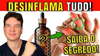 O 1 Melhor Antiinflamatório Natural para Artrite NÃO É O QUE VOCÊ PENSA  TOME PRÓPOLIS CERTO [upl. by Adnohsek]