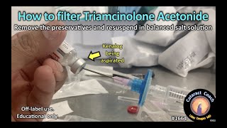 CataractCoach™ 1664 how to filter triamcinolone acetonide Kenalog [upl. by Leihcim278]