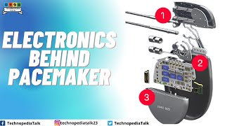 Electronics Behind Implantable Pacemaker  Block Diagram of Pacemaker  Technopedia Talk [upl. by Nossila]