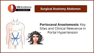 Portocaval Anastomosis Key Sites and Clinical Relevance in Portal Hypertension [upl. by Nylaret]