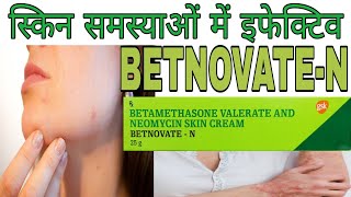 BETNOVATEN Cream Benefits and side effects in Hindi  Betamethasone Neomycin skin cream [upl. by Richelle]