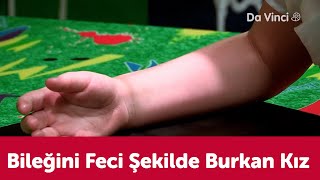 Amuda Kalkarken Bileğini Burkan Kız🤕  Görevimiz İnsan Vücudu  Da Vinci TV Türkiye [upl. by Lassiter]