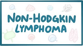 Nonhodgkin lymphoma  causes symptoms diagnosis treatment pathology [upl. by Luaped498]