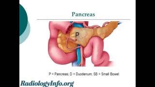 MRCP Radiologist Explains Magnetic Resonance Cholangiopancreatography [upl. by Eidna]