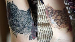 Laser Tattoo Removal Journey  Before and After Shorts [upl. by Ferd]