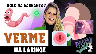 Vermes na Laringe [upl. by Ettolrahs]