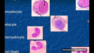 Leukopoiesis formation of White Blood Cells [upl. by Aztinad]