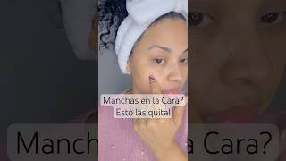 Manchas en la cara Esto las quita skincare  skincaretips skin glowingskin healthyskin [upl. by Cramer]