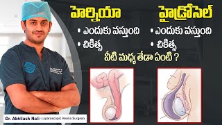 వీటి మధ్య తేడా ఏంటి  Difference Between Inguinal Hernia and Hydrocele In Telugu  Dr Abhilash Nali [upl. by Ahsielat939]