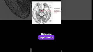 Mots science médicale [upl. by Daniel247]