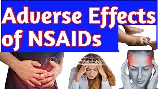 Antiinflammatory NSAIDs Drugs Adverse Effects Side Effects of NSAIDs Pharmacology pharmacist [upl. by Eolanda235]