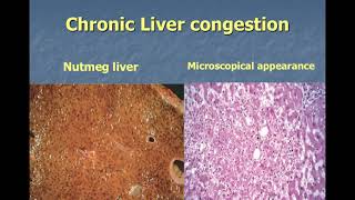 Hyperemia and Congestion [upl. by Schwarz]