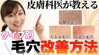 【タイプ別】エビデンスに基づく毛穴改善方法を皮膚科医が徹底解説 [upl. by Aihsemak128]