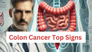 Colon Cancer Alert 5 Warning Signs You Must Know [upl. by Ynoep]