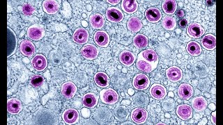 Infección por citomegalovirus parte 1 Características virológicas y vías de transmisión [upl. by Aerahs]